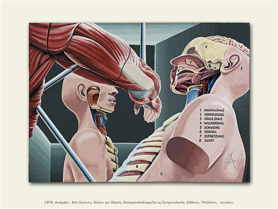 %_tempFileName12_krank_1978%